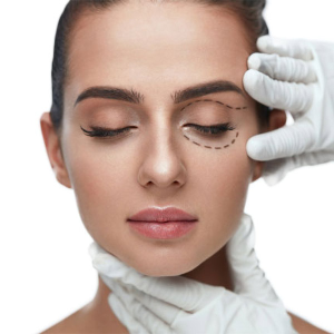 A female patient with an outlined area around the eye in preparation for a cosmetic procedure.