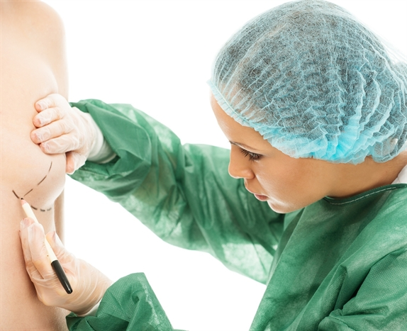 A doctor marking the breast of a female in preparation for a cosmetic surgery procedure.