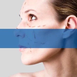 Facelift and Necklift - Cosmetic Procedure.