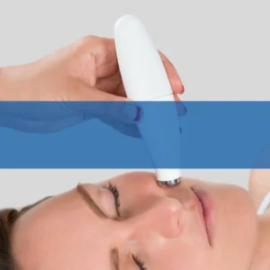 Microdermabrasion - Cosmetic Procedure.